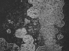 Syme_James_2 Syme_James_2